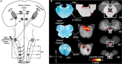 Supraspinal Mechanisms Underlying Ocular Pain